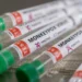 Com 709 casos de mpox no Brasil, ministério convoca reunião