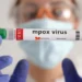Brasil supera marca de mil casos de mpox em 2024