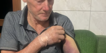 PUTINGA | Homem é picado por jararaca ao colher cana-de-açúcar
